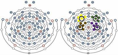 Brain Activity During Unilateral Physical and Imagined Isometric Contractions